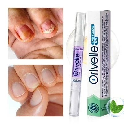 Orivelle